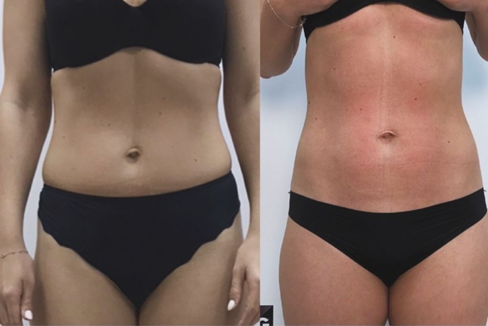 Масаж/Харків  поруч з метро ( Григорія Сковороди 79/1)