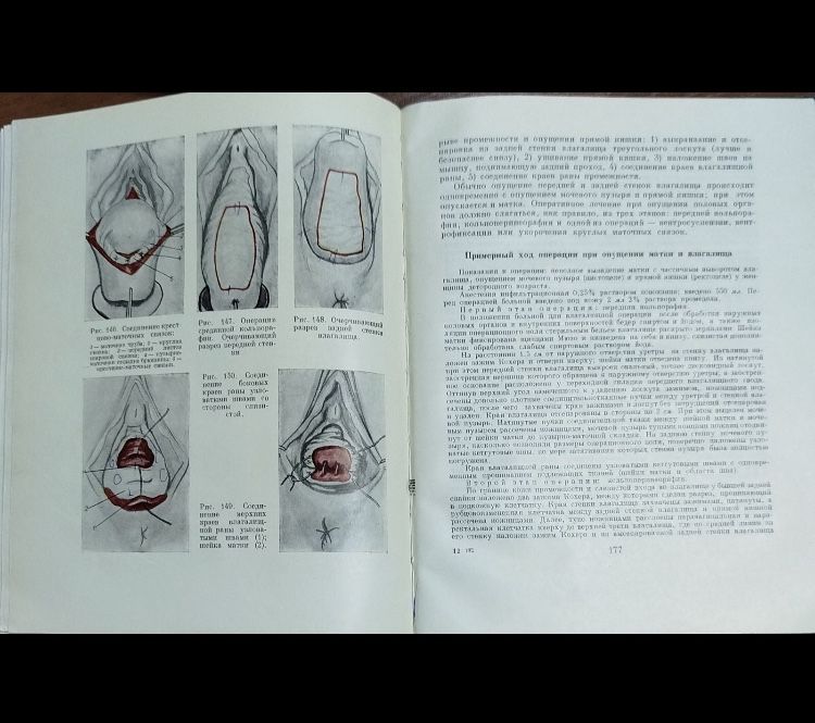 Рембез І.Н. Оперативна гінекологія.