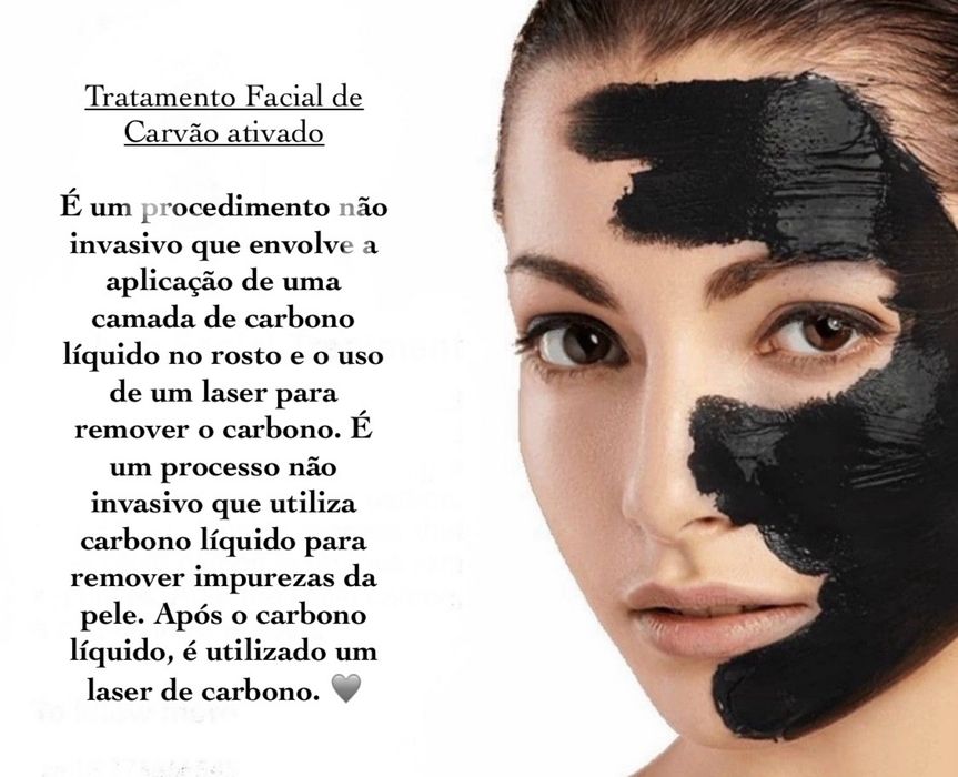 Tecnica de remocao de tatuagem, peeling e outros.
