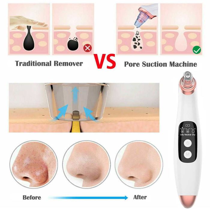 Вакуумный очиститель пор кожи профессиональный уход за кожей дома