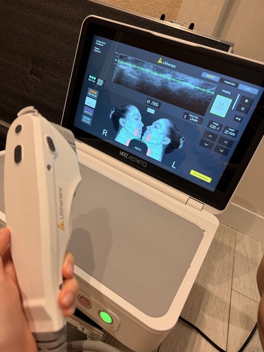 Апарат смас ліфтинг smas lifting ulthera ultherapy prime аппарат