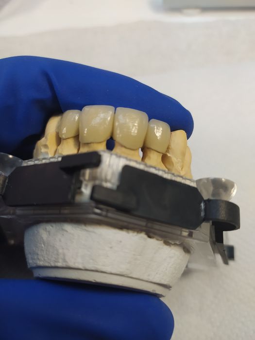 Зубний Технік /Металокераміст