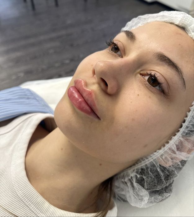 Акція!!!Контурна пластика губ за 2000!!!