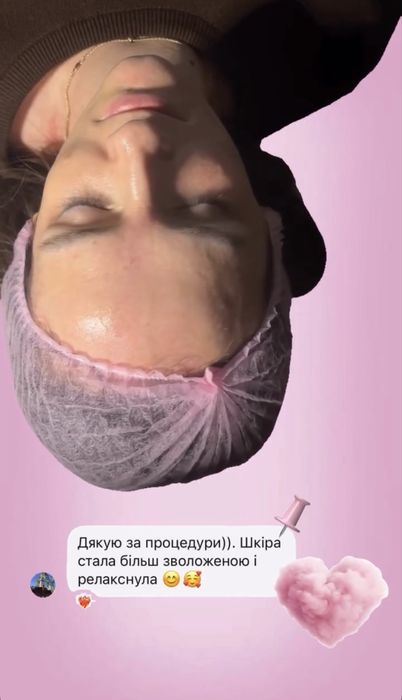 Косметолог (шукаю моделей)