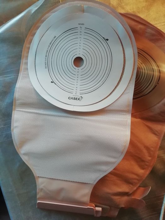 Калоприемник. Стома