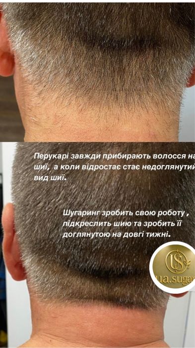 Чоловіча, жіноча депіляція, шугаринг, Миколаїв.