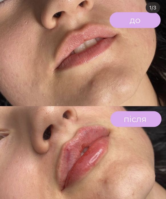 Треба моделі срочно