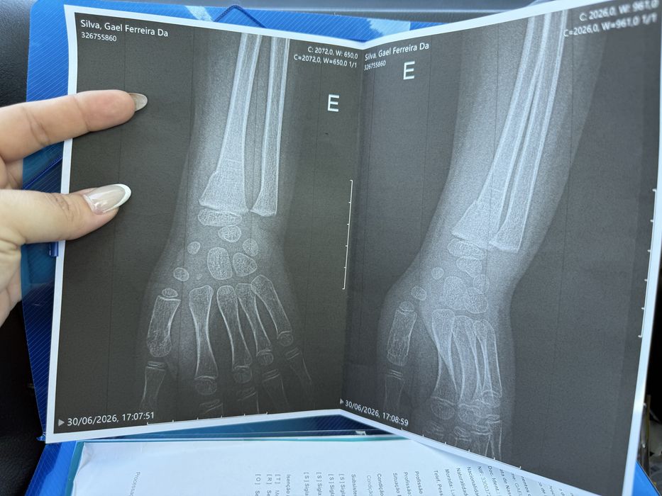 Unhas de gel, extensão e verniz gel