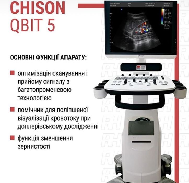 УЗД апарат Chison QBIT 5