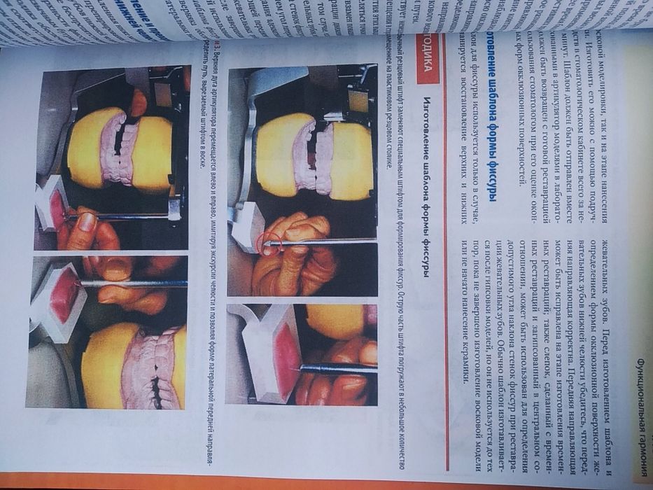 Функциональная окклюзия. Доусон. Стоматология. Гнатология