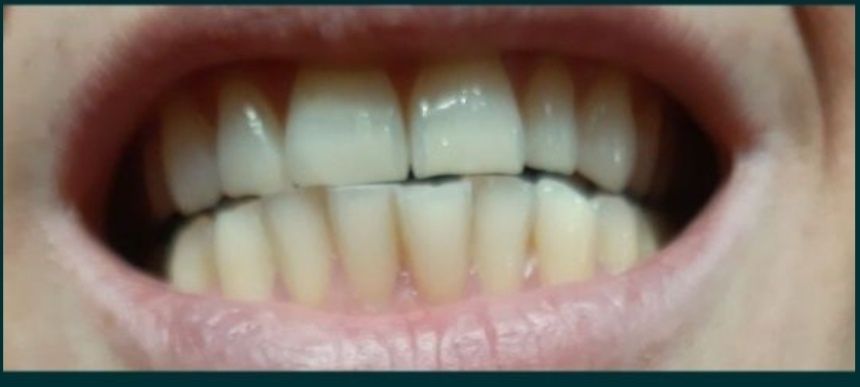 Zestaw nu skin ap 24 wybielająca pasta i insta glow