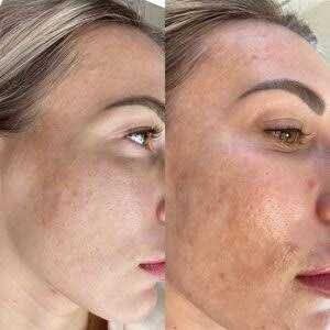 косметична хіджама