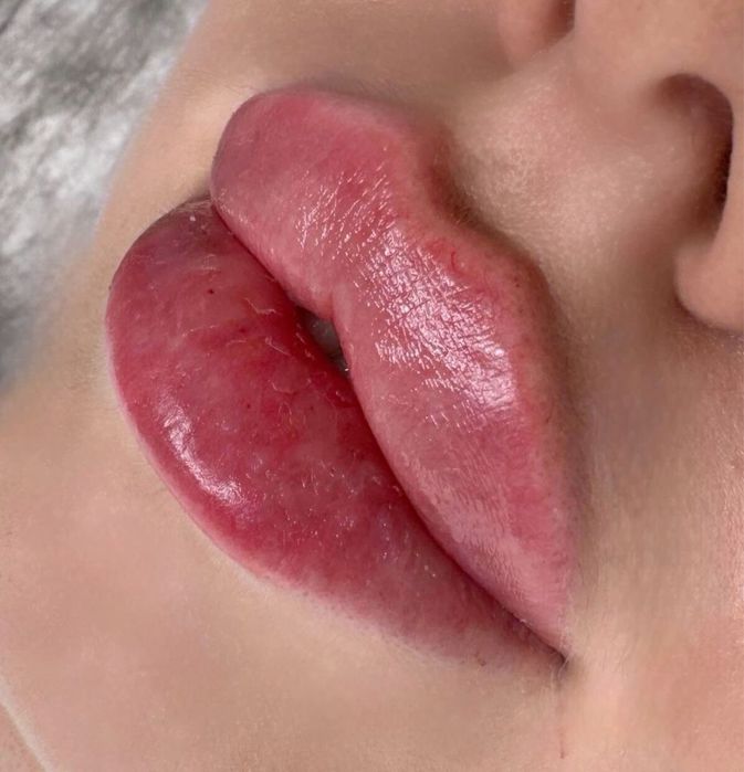 АКЦИЯ СКИДКИ Нужны МОДЕЛИ на увеличение губ для портфолио