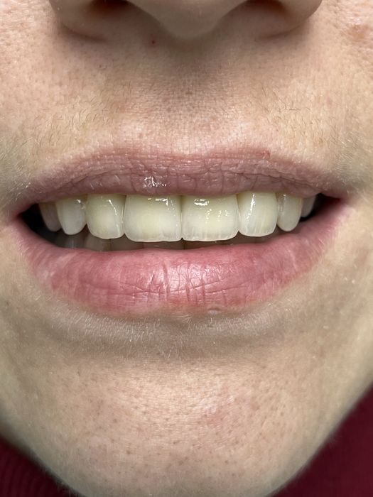 Зубний технік,Одеса,Котовського.