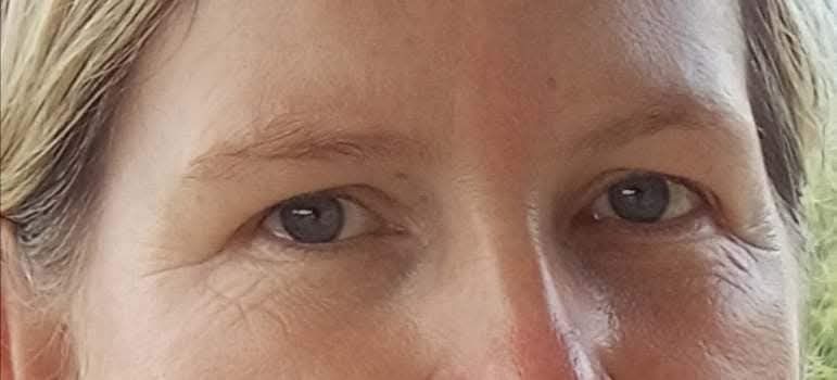 Hyaluron Pro. Ultranawilżające serum