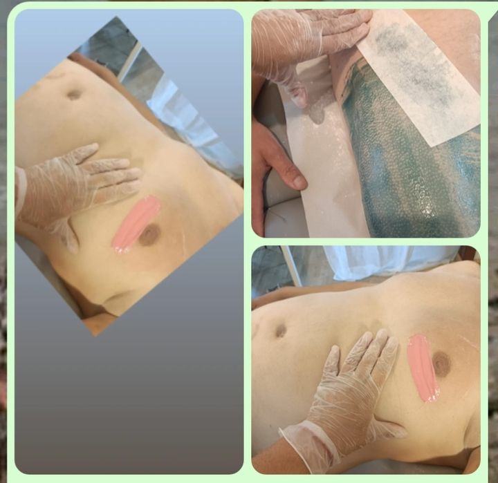 Depilação Masculina