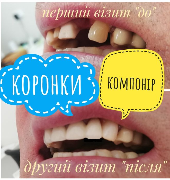 стоматолог, стоматологія, лікування зубів, карієсу, протезування