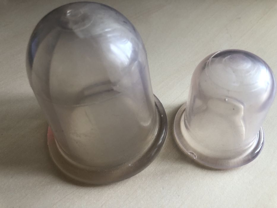 Банки масажні вакуумні для масажу тіла