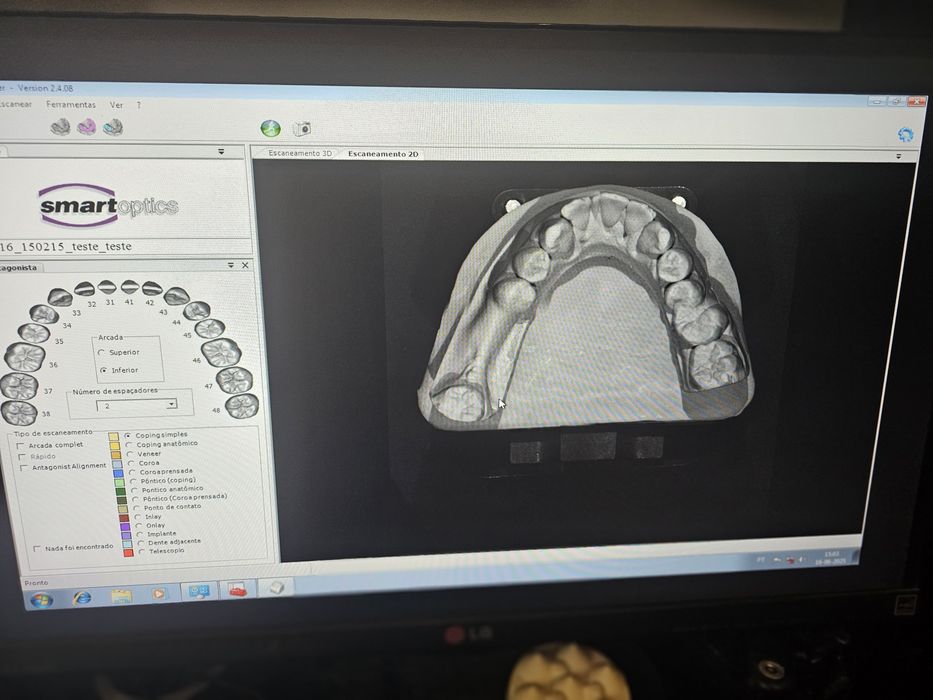 Scanner dentario smartoptics