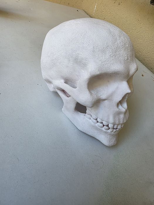 Cranio Humano impresso em 3D