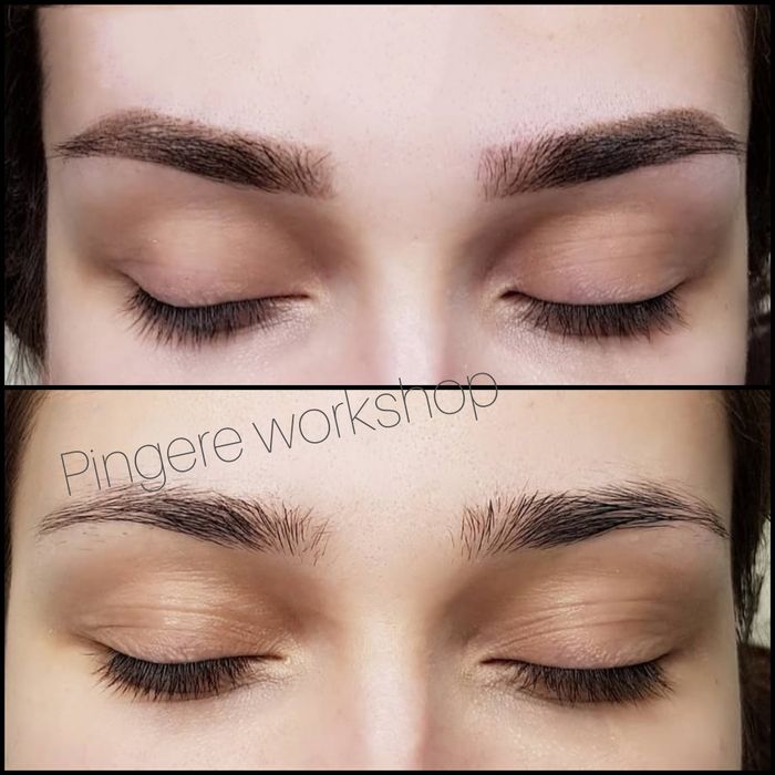 Безпечне лазерне видалення тату, татуажа.