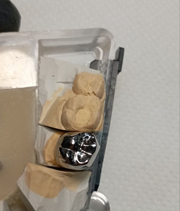 Зубний Технік /Металокераміст