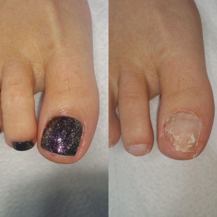 Pedicure, podolog Gdańsk