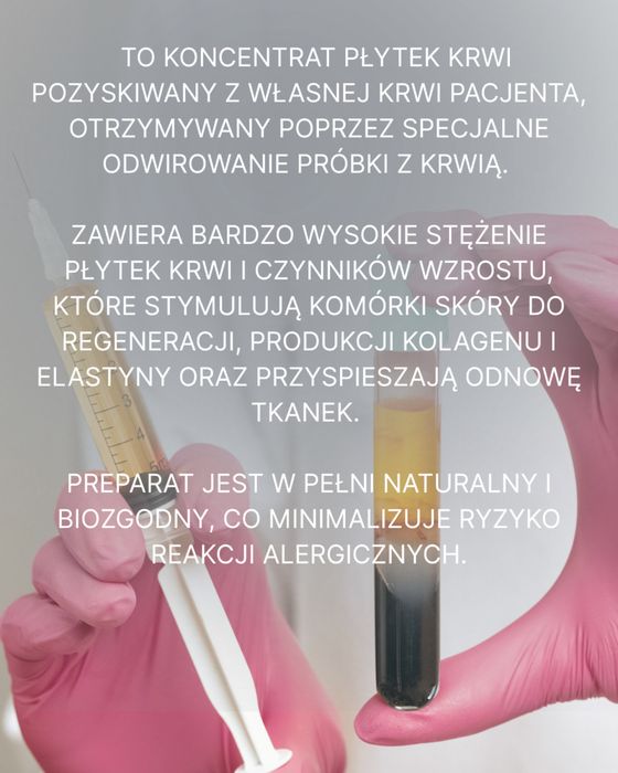 Osocze bogatopłytkowe