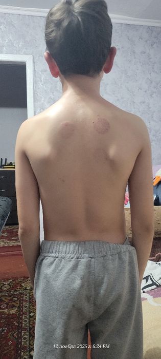 Лікувальний Массаж тіла