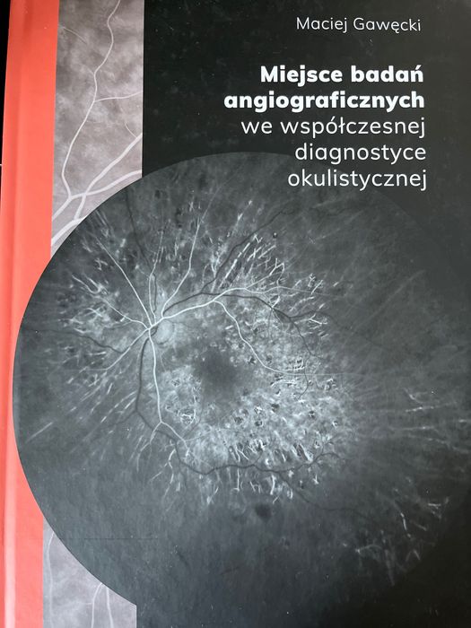 Miejsce badań angiograficznych w diagnostyce okulistycznej Gawęcki M