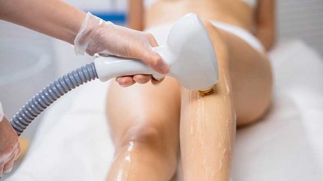 Depilação a laser promoção