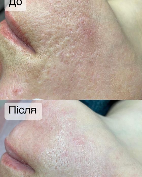 Косметолог, эпиляция