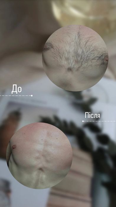Воскова депіляція