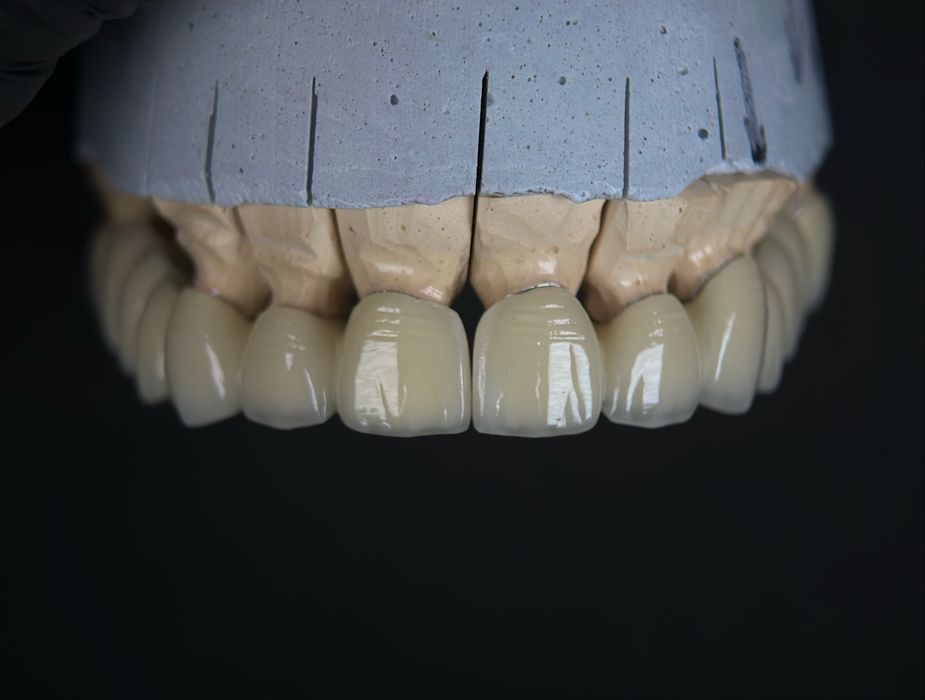 Послуги зубного техніка