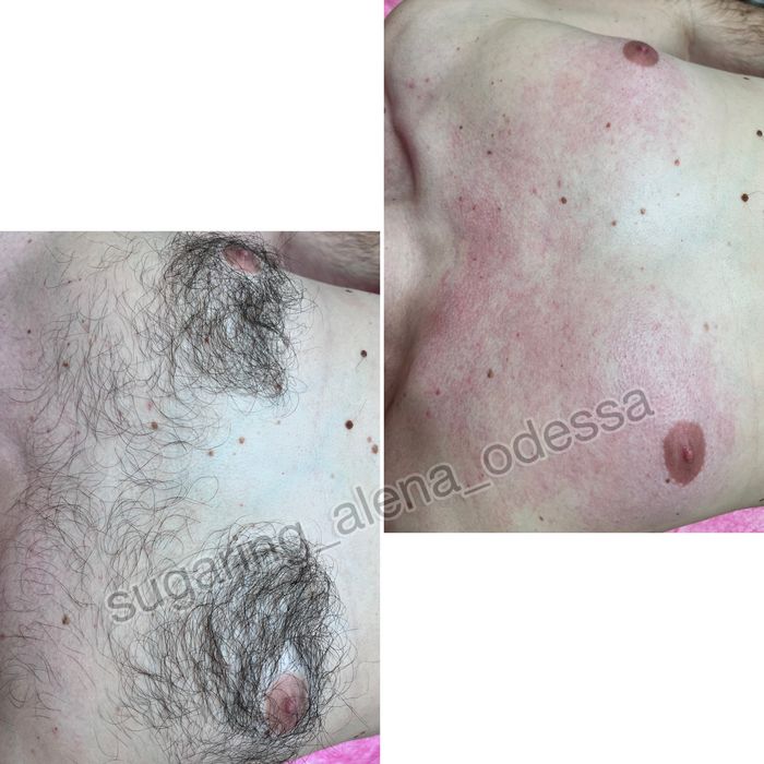 Шугаринг Воск Центр