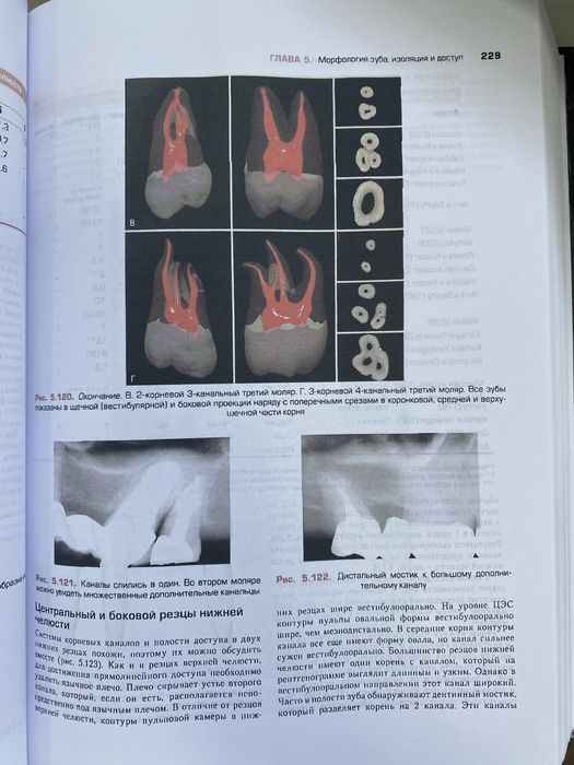 Книга Ендодонтія