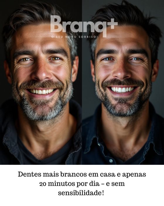 Kit de Branqueamento Dentário