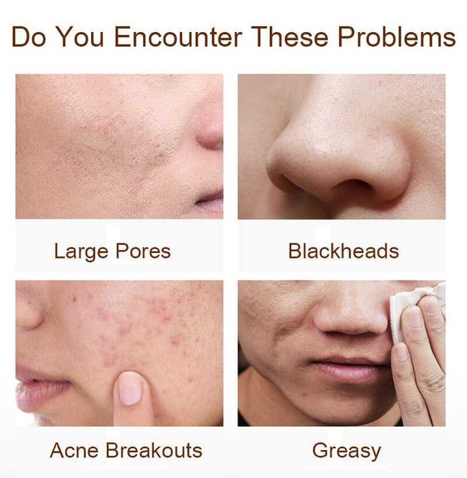 FOTOTERAPIA DE LEDS 7 CORES - PHOTONS LEDS TRATAMENTOS ROSTO