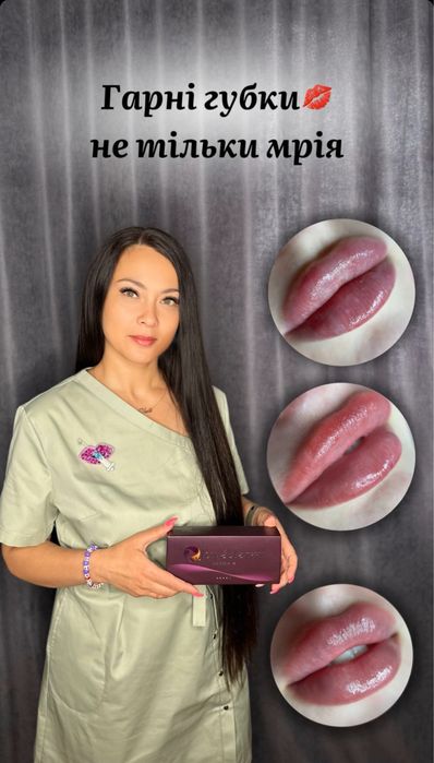 Збільшення губ , ботокс, косметолог