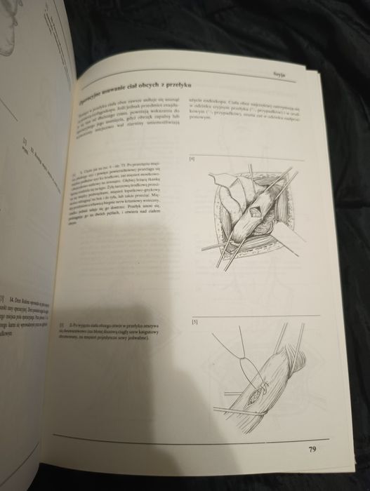 Chirurgia operacyjna tom l