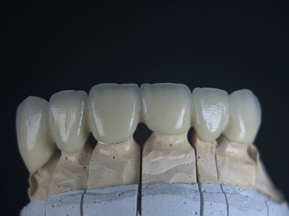 Послуги зубного техніка