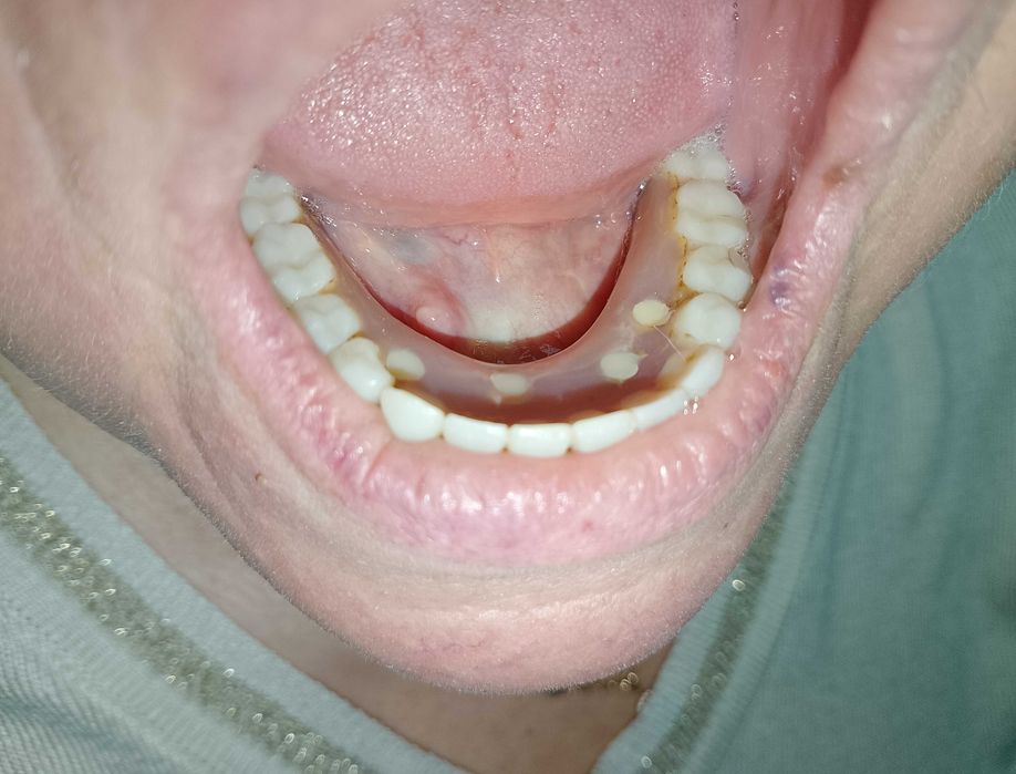 Стоматология. Протезирование .Имплантолгия