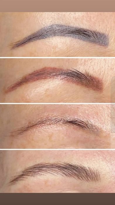 Лазерное удаление тату/татуажа -700 грн! Техника волосок-2500 грн