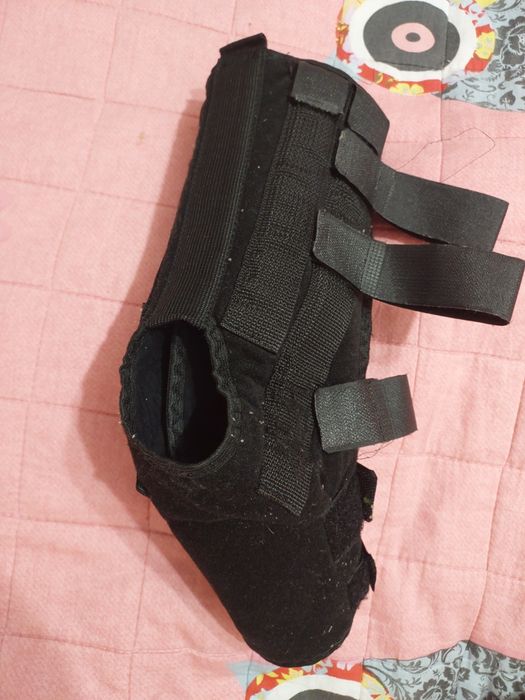 Ортез з жорстокими ребрами