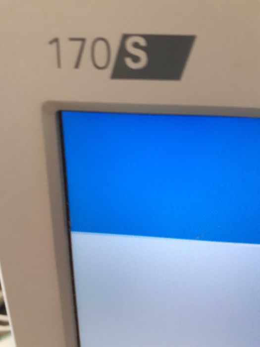 Monitor PHILLIPS 170S6439109655798763521