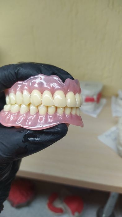 Услуги зубного техника.