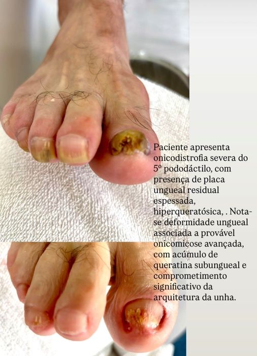 Podóloga cuidado e saúde dos pés