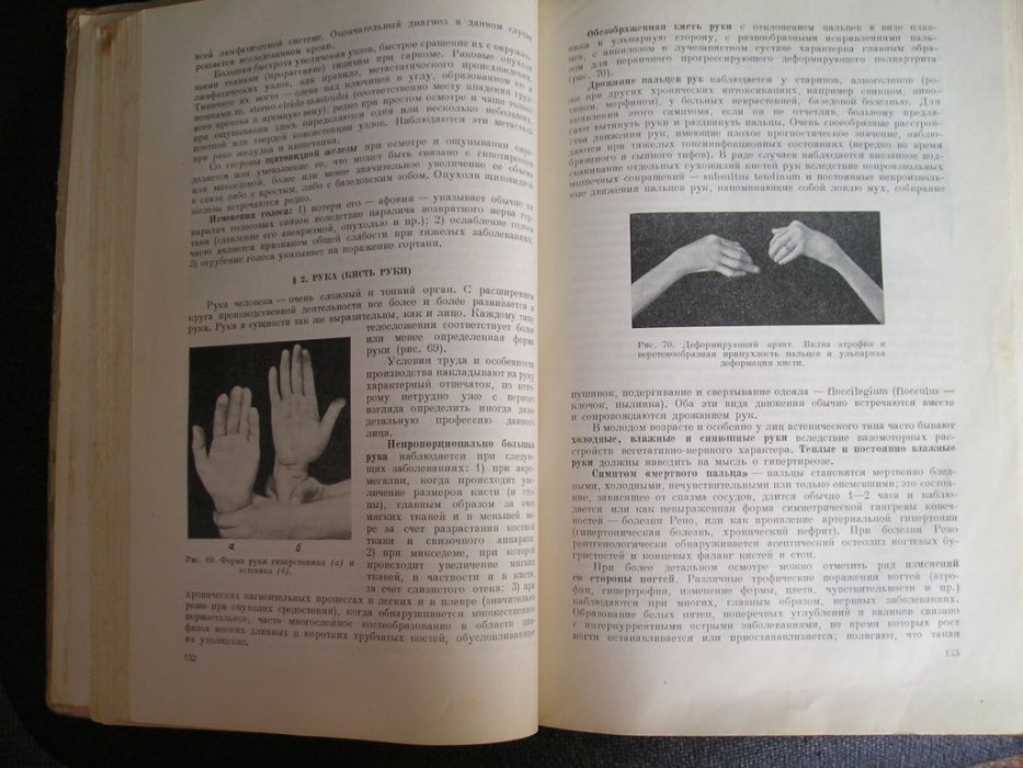 Черноруцкий Диагностика внутренних болезней 1953 г. (медицина)