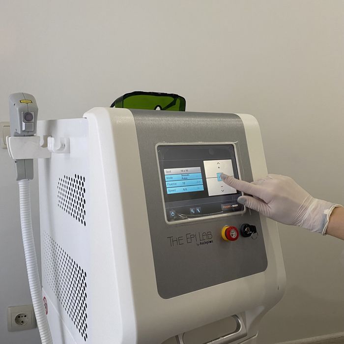 Оренда лазерного апарату The Epilab (Німеччина)