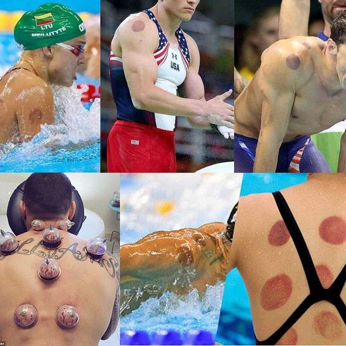 АРАБСЬКА ХІДЖАМА - вакуумна терапія